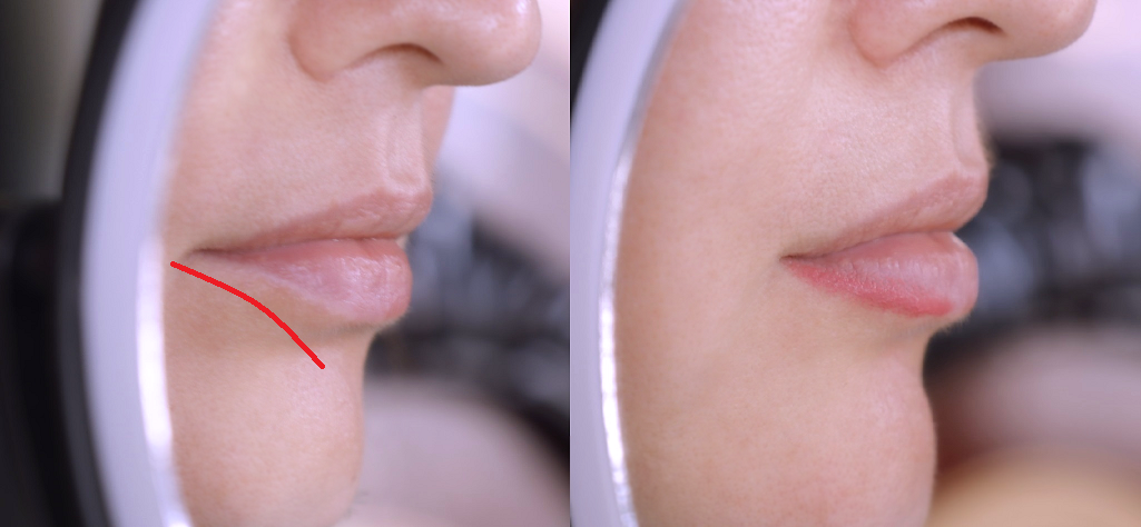 Поджимание губ не добавляет красоты внешнему виду