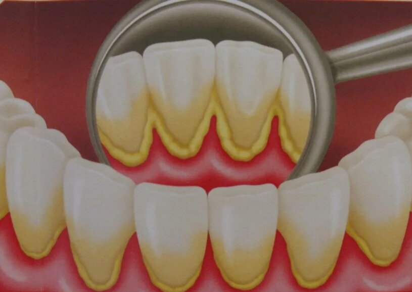 фото: vksp7.zdrav36.ru