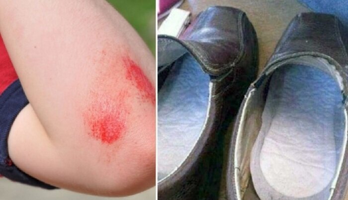  Чисто мужские способы применения гигиенических прокладок.