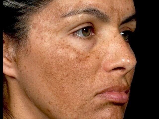 5 основных причин раннего старения кожи...