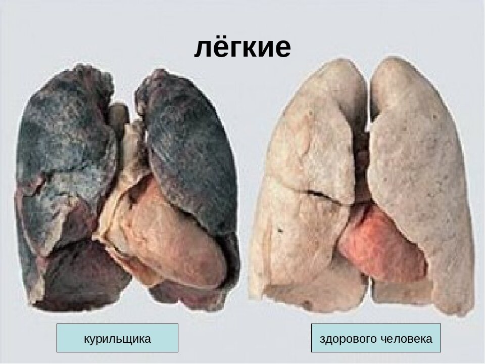 Наверное такие легкие были у меня.
