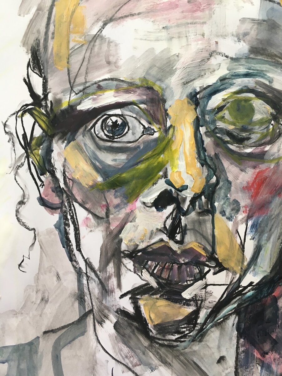 А вот и еще одна правдивая  история          реального человека!                               "Привет, меня зовут Никита✋Сейчас наконец-то я счастлив и нашёл свою любовь, но два года назад все было иначе. 😔 Я бывший спортсмен и не из робкого десятка,первый звоночек к паническим атакам я получил,
когда получил травму в спорте и не смог
заниматься им дальше. Затем начались поиски работы, нервное напряжение, безответная любовь, неуверенность в себе. Было не то окружение, которое у меня есть сейчас. Как сейчас помню: случилось все 25 февраля 2017 года. Выйдя утром с собакой, я прикурил сигарету и у меня начало мутнеть в глазах, сердце забилось так, будто оно сейчас выпрыгнет. Первое, что я подумал - это инсульт. (На секунду,
мне  22 года😆). Я начал ходить по врачам проверять сердце, естественно,
отдал кучу денег. Все было нормально, но
симптомы не проходили. У меня началась дикая дереализация, ипохондрия, за ней само собой и агрофобия . Ходил по всем врачам, впуливая кучу денег, ездил к 3 гадалкам😂, но моё состояние не улучшалось. Дошло до того, что я боялся выйти на лестничную клетку к друзьям. После хождения по врачам и
не услышав внятного ответа на мои вопросы, я как и все начал искать загадку своего таинственного "заболевания"прочитал на одном
из форумов что это все связано с шейным
отделом позвоночника и остеохондроз ,я
воодушивившись этой темой, думая что нашёл ответ, пошёл делать свое мрт шейного отдела позвоночника, от моих занятий спортом в шее действительно была протрузиия, но она никак не
связанна с паниками и всд, хирурги 
утверждали что все хорошо и делать тут нечего не надо! а я звонил помню хирургам и говорил что меня
нужно срочно оперировать! После такого врачи послали меня прямым текстом на х....й😜                                                                                     И я начал искать остеопатов и манульных теропевтов, не спорю они не плохо разминают и испраляют огромное количество травм, но никак
не связанных с паничискими атакам и всд, ну и соответственно кроме того как крутить мне шею на 360 градусов ничего не изменялось, а у меня появился за это время страх даже тяжёлые пакеты нести !Потом я хотел поехать к массажисту в другой город, и он уверял, что вылечит панические атаки массажем, и что все эти состояния из-за переохлаждения, и самое что смешное что я поехал с друзьями купаться и была холодная вода и там была одна из моих самых сильных паничиских атак, меня трясло тогда так, что обкакались даже мои друзья😂 которые наблюдали уже год за моим состоянием!И так вот я поверил , что это от переохлаждения
и ходил всем доказывал что это из-за этого. А тот врач поставил условие, говорит "как вы приезжаете ко мне вам надо будет снимать ещё у меня квартиру", которую сдавал он тоже не
дешево ну и соответственно массаж за
отдельные деньги, находиться он сказал надо там две недели чтобы якобы эффект закрепить! Вот тут то  я и понял, что откровенно говоря меня разводят, и я
начал сам разбираться с этой болезнью! Начал сам ее изучать!"
