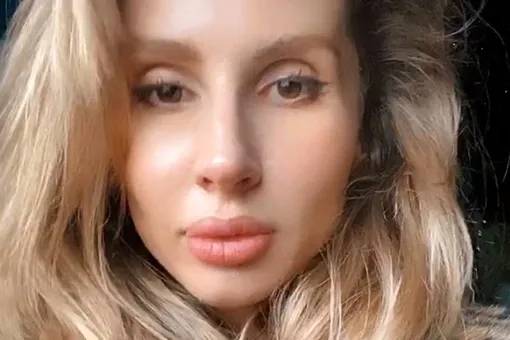 «Я сделала пластику и уменьшила нос?»: Светлана Лобода показала свои честные фото.