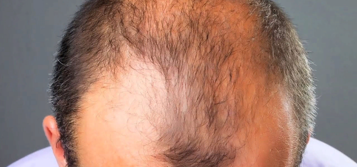 фото взято из интернета