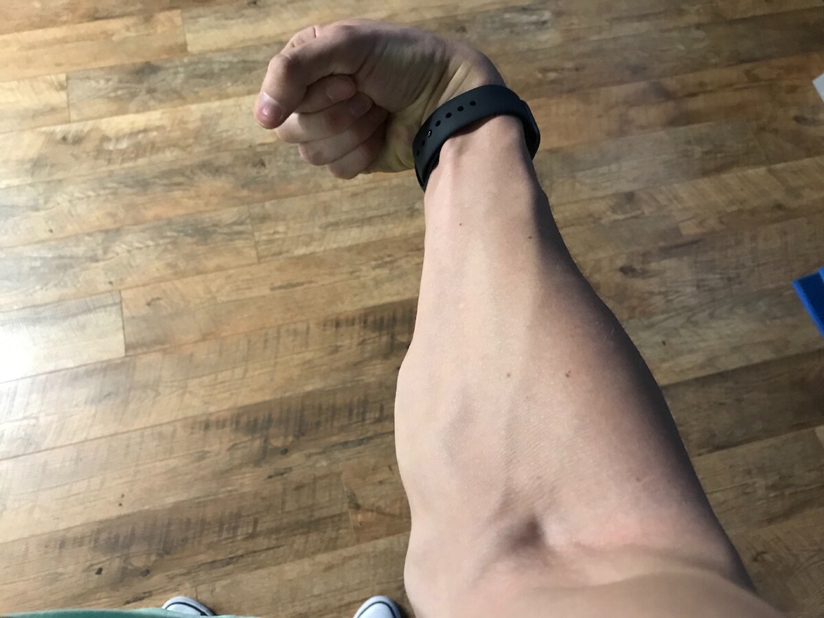 Похоже на предплечье, способное поднять 100 кг одной рукой без замка?:)