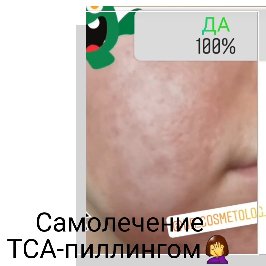 Плохая реабилитация