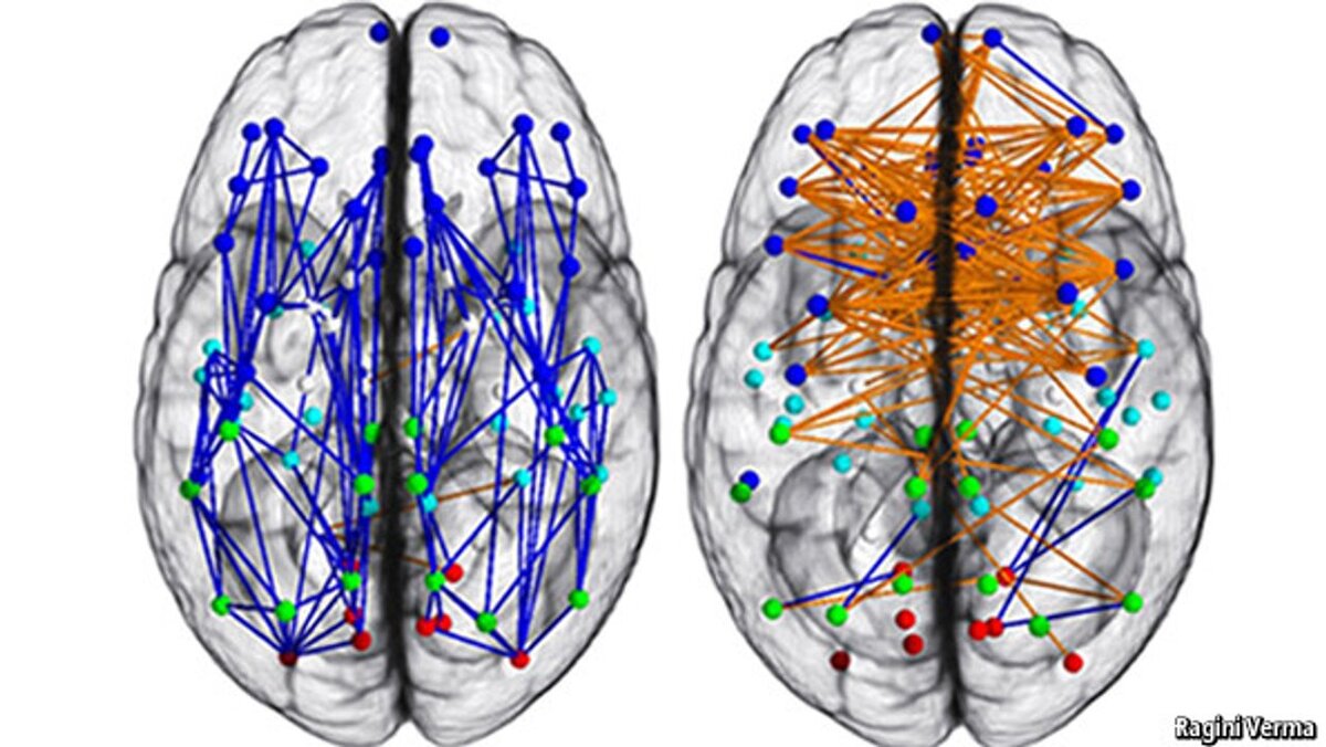 Слева - Мужской, Справа - Женский. Источник: economist.com/science-and-technology/2013/12/07/vive-la-difference