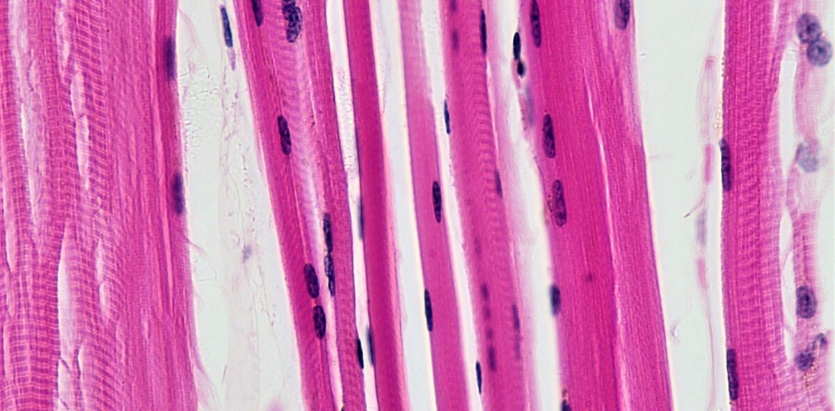 Мышечные волокна поперечнополосатой скелетной мышцы. Public Domain