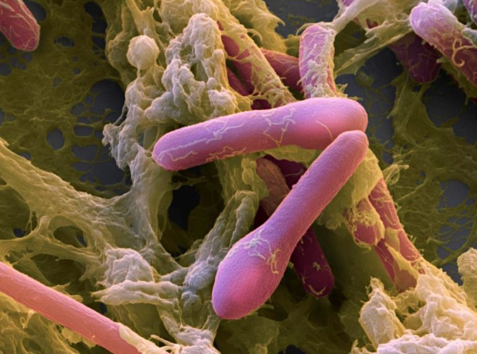 Clostridium botulinum 