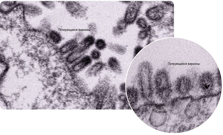 Как выглядят опасные вирусы под микроскопом