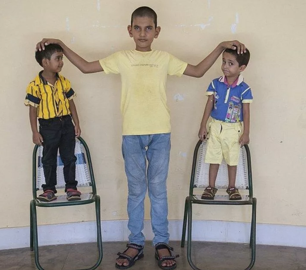 2 ребенок с огромным. Каран Сингх самый высокий ребёнок. Высокий мальчик. Самый высокий мальчик в мире. Самый длинный ребенок.