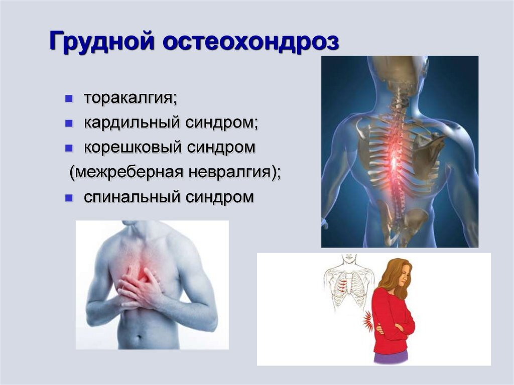 Куда отдает боль при грудном остеохондрозе картинки