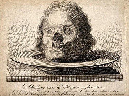 Немецкий художник Альбрехт Дюрер  (1471— 1528) создал гравюру на дереве, которая была напечатана в 1496 г. как листовка вместе с предупреждениями о сифилисе нюрнбергского врача Теодора Улсениуса.  В тексте описываются признаки и симптомы заболевания и говорится, что его невозможно вылечить. 