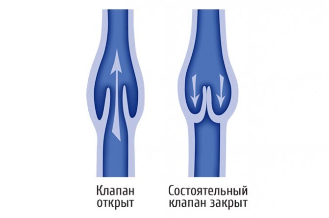 Функционирующий венозный клапан.