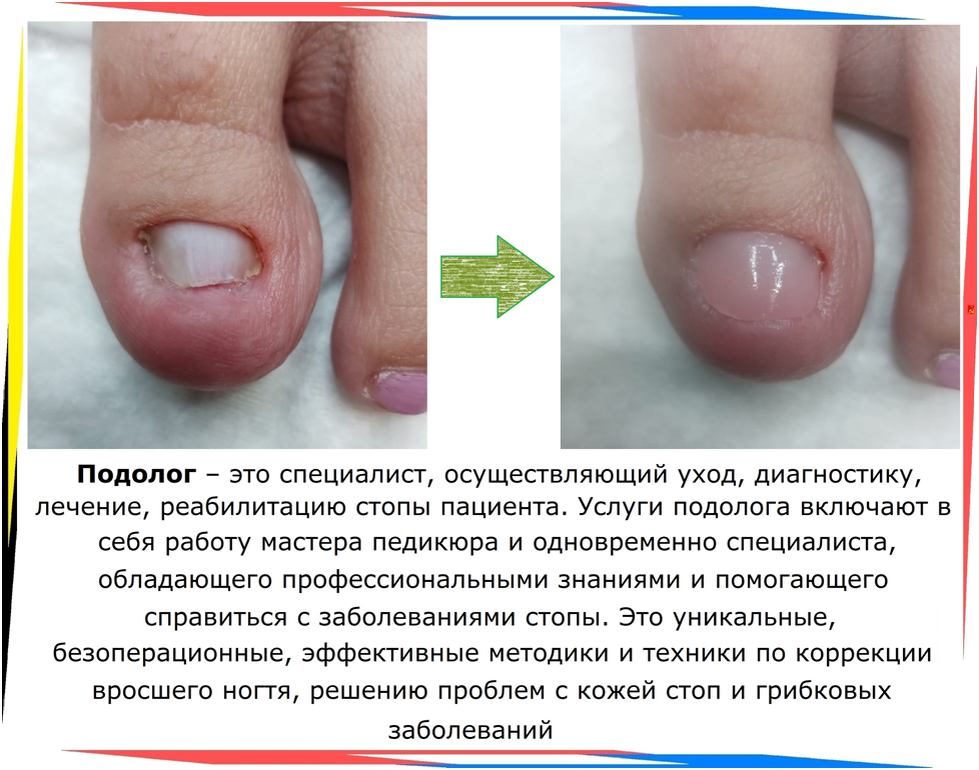Мастерство подолога