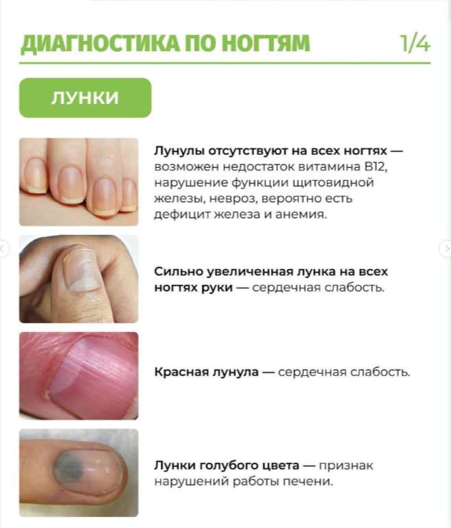 Диагностика организма по ногтям: о чём говорит состояние ногтевых пластин