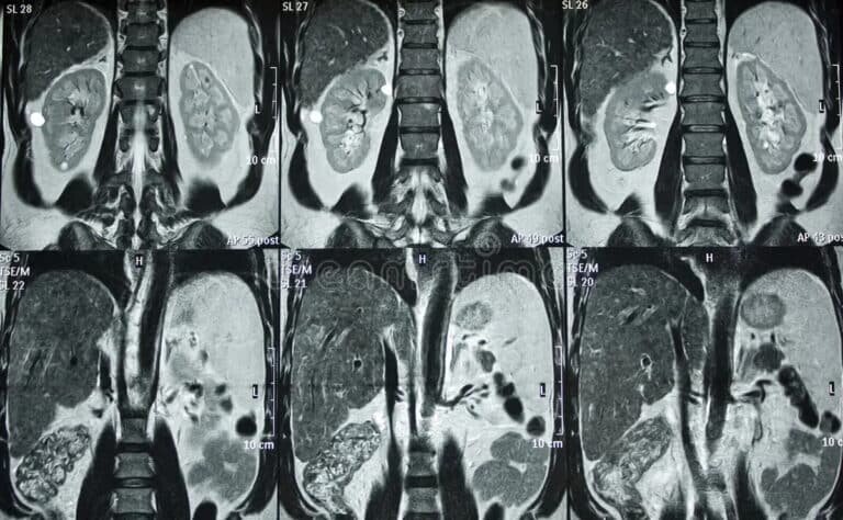    Снимок брюшной полости / © Getty images