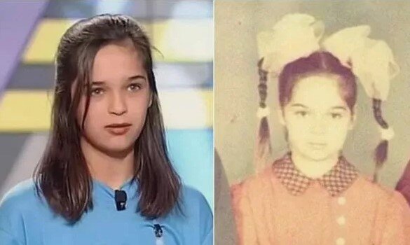 Ахмедова до и после пластики