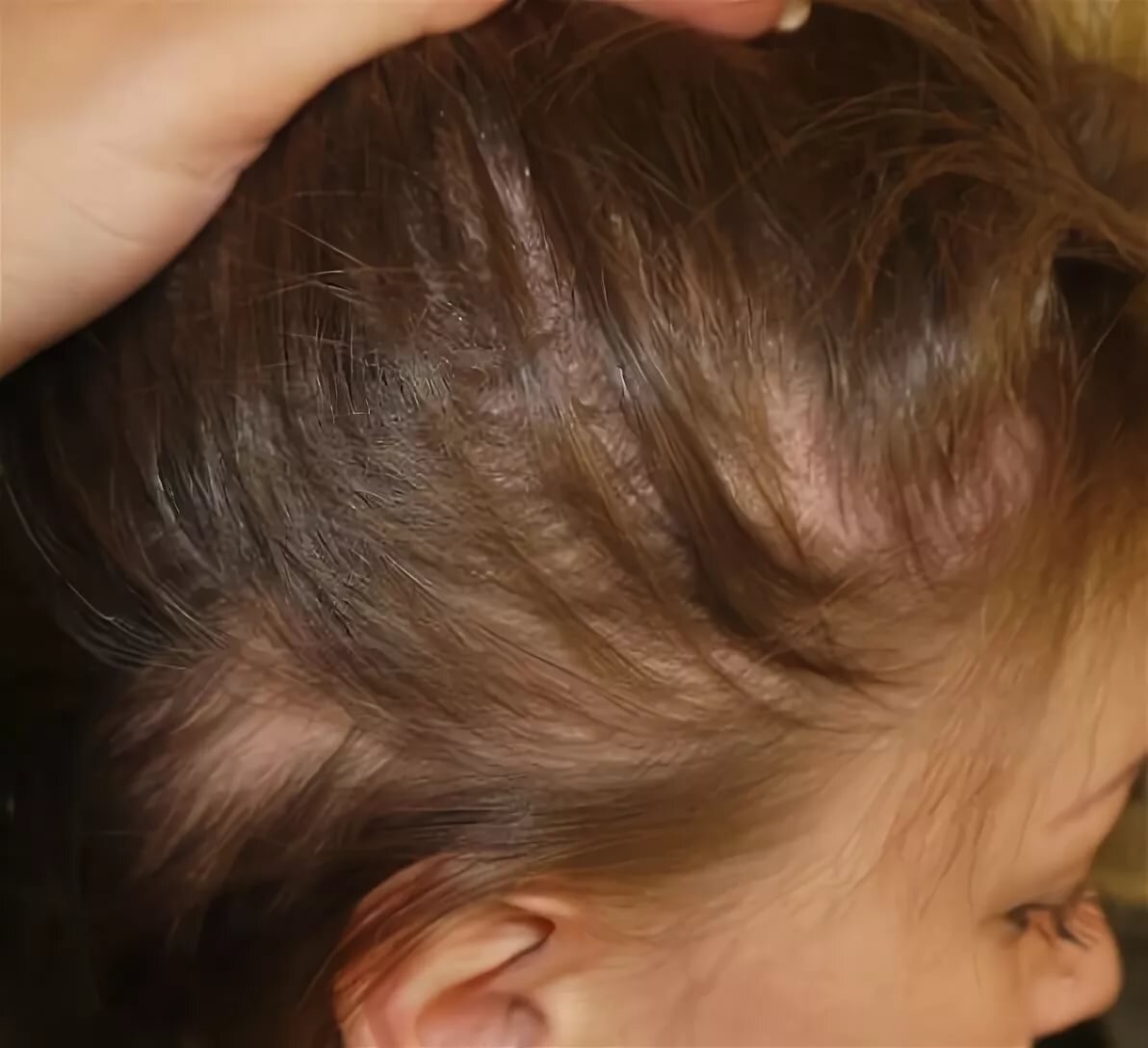 Причины выпадения волос у подростка. Редкие волосы у ребенка.