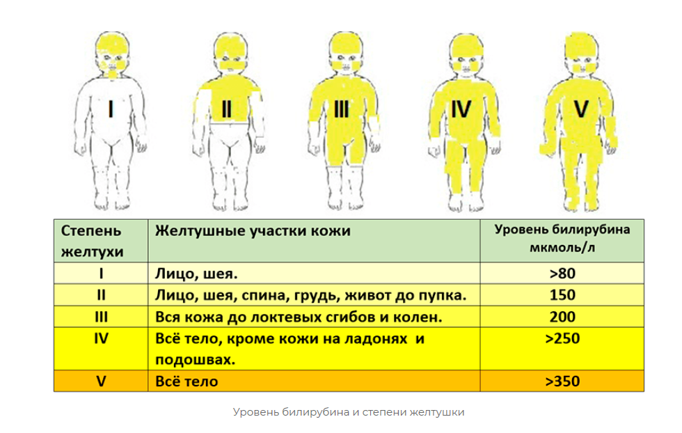 Степени желтушки.