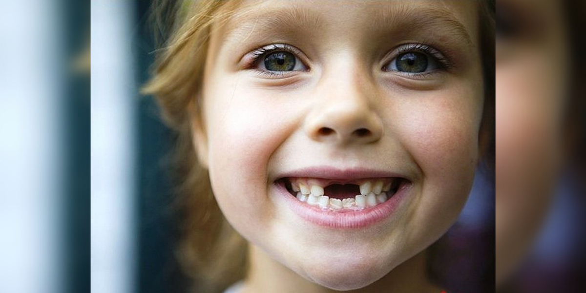 Молочные зубы. Фото с сайта - https://clck.ru/YktyZ