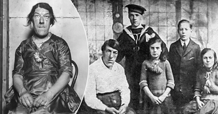 Болезнь. Мэри с детьми