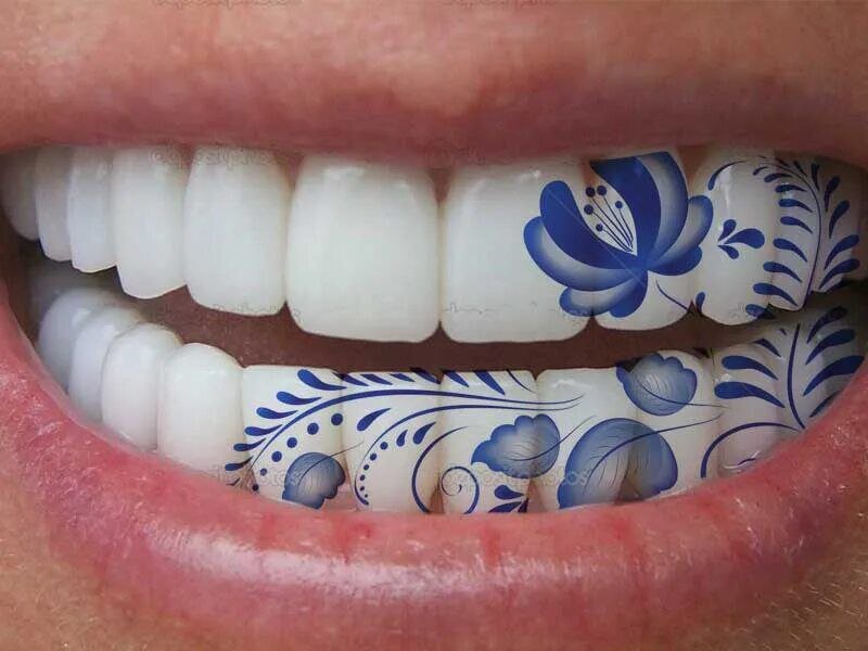 гравировка зуба