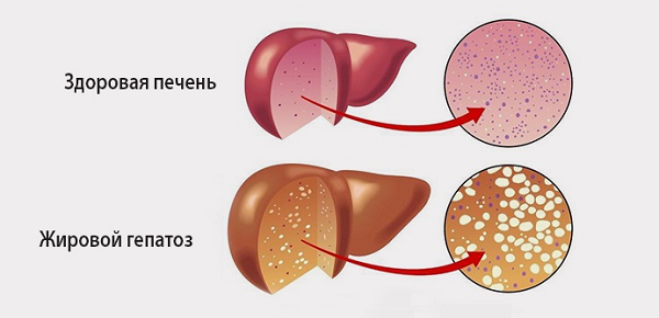 фото: https://expert-gepatolog.ru