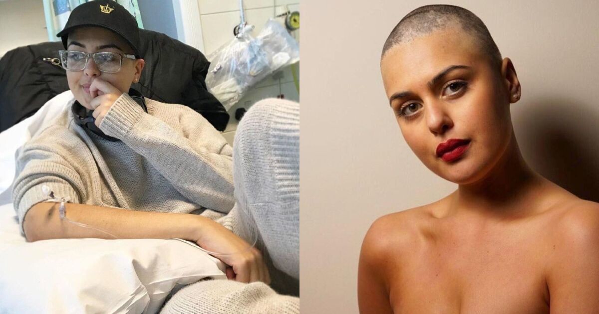 Лорен после химиотерапии