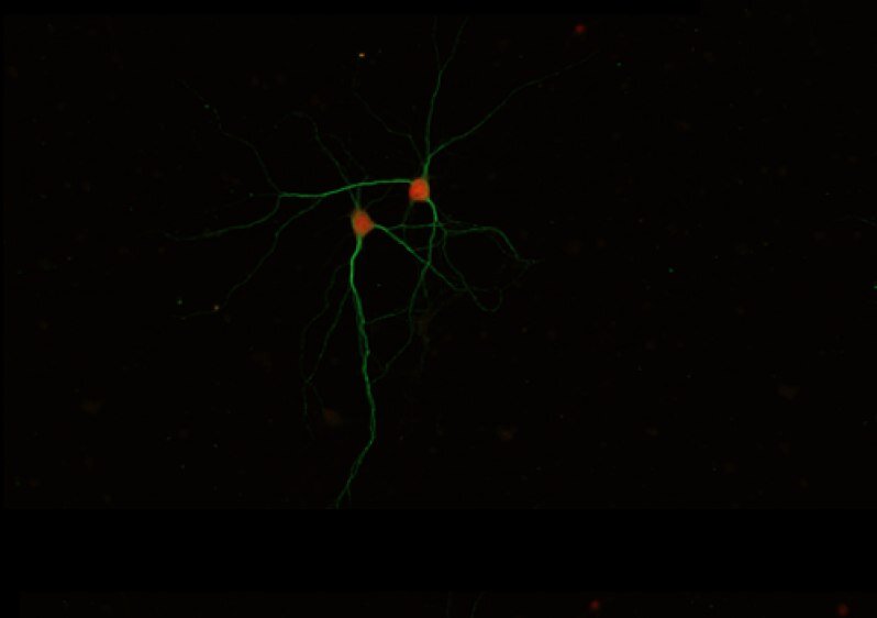  И снова  перед вами просто фотография из конкурса NeuroArt. Перед вами — просто пара кортикальных нейронов, выращенных в культуре.  Ничего необычного, но очень красиво.