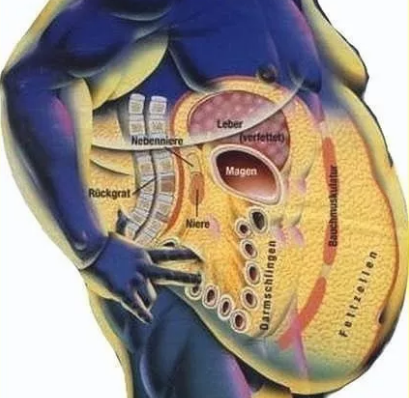 Фото жира на животе изнутри