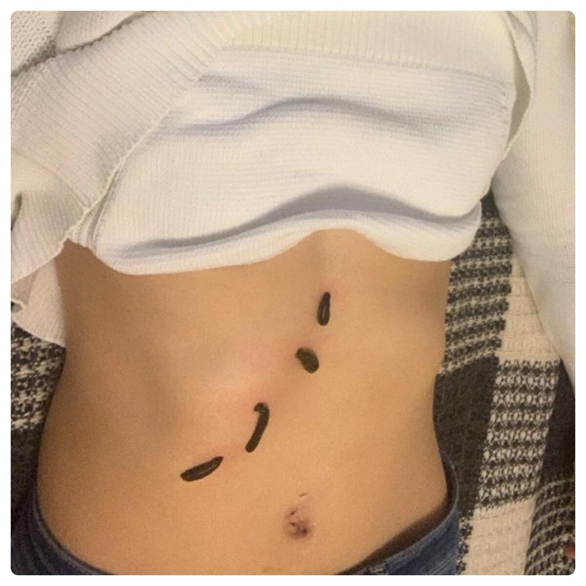 Это на 5 постановке, чистка печени