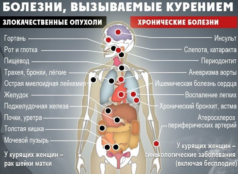 Болезни, вызываемые курением