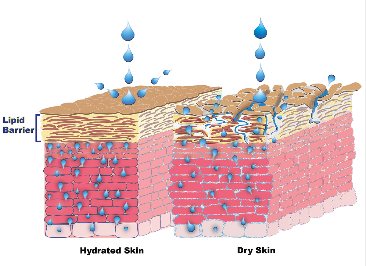 Защитный липид. Эпидермальный барьер и гидролипидная мантия. Эпидермальный барьер гидролипидная мантия и кожи это. Строение кожи водно-липидная мантия. Эпидермальный барьер липидная мантия.