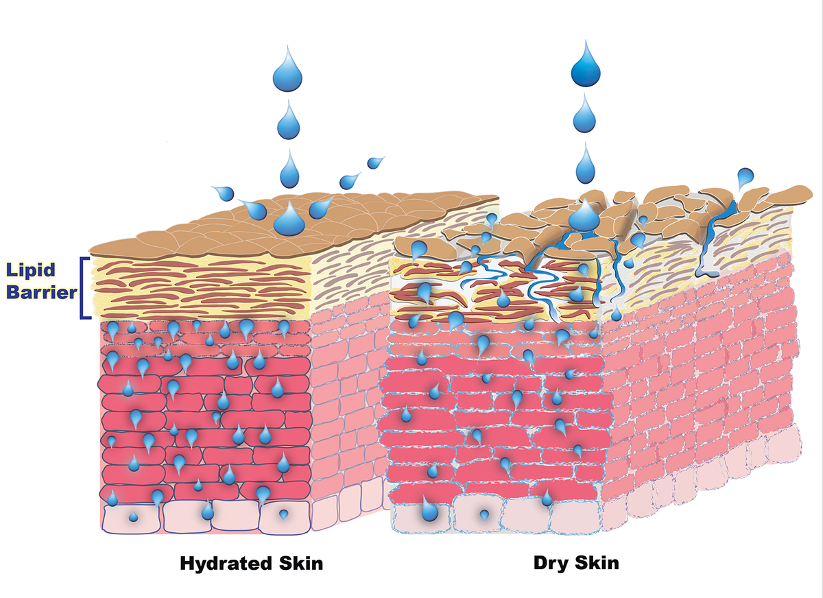 Влага кожи. Эпидермальный липидный барьер. Гидролипидная мантия и эпидермальный барьер. Эпидермальный барьер гидролипидная мантия и кожи это. Строение эпидермиса гидролипидная мантия.