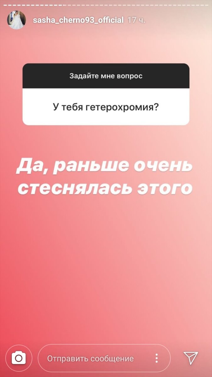 Девушка переживала из-за глаз разного цвета
Фото: «Инстаграм»