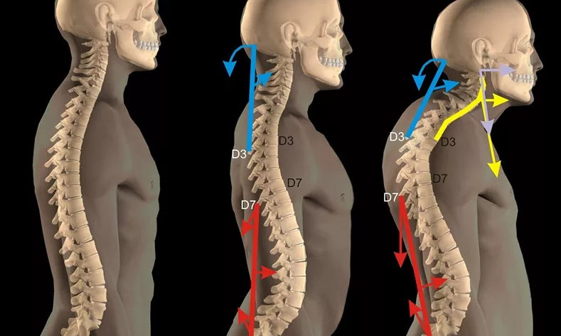 Линии перенапряжения  при изменении осанки