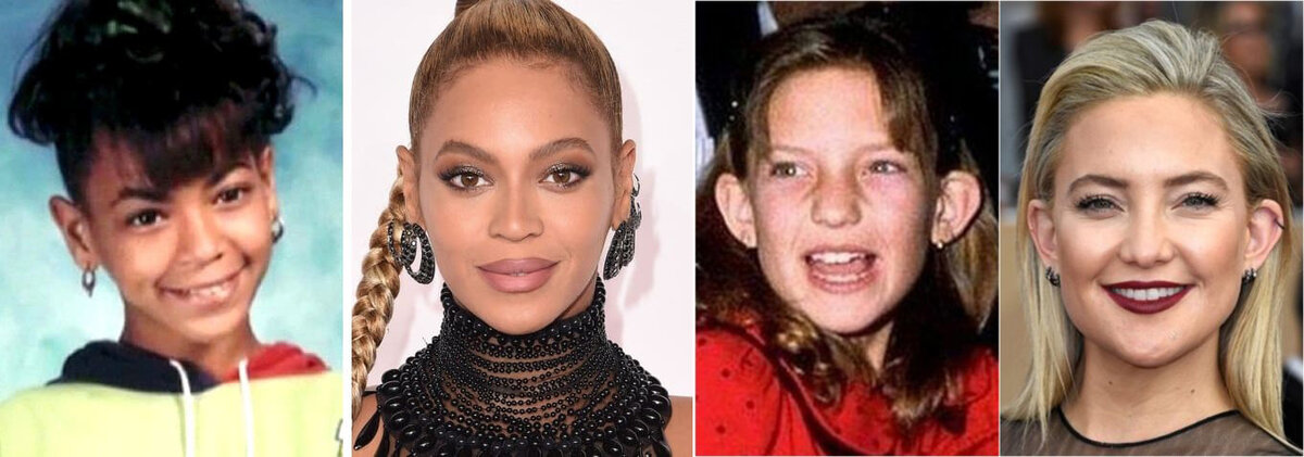 Бейонсе и Кейт Хадсон не скрывают, что проходили через пластику ушей. Фото взято из открытых интернет источников.