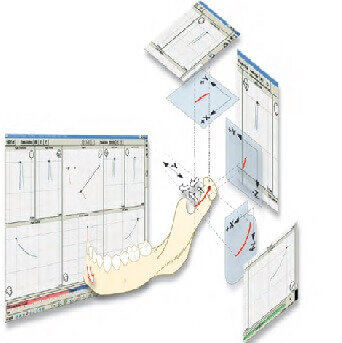 Основными показаниями к проведению электронной аксиографии являются: