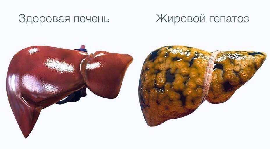 Источник: Яндекс. Картинки