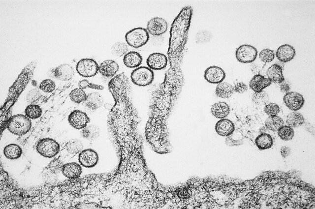 Хантавирус. Фото: Public Domain