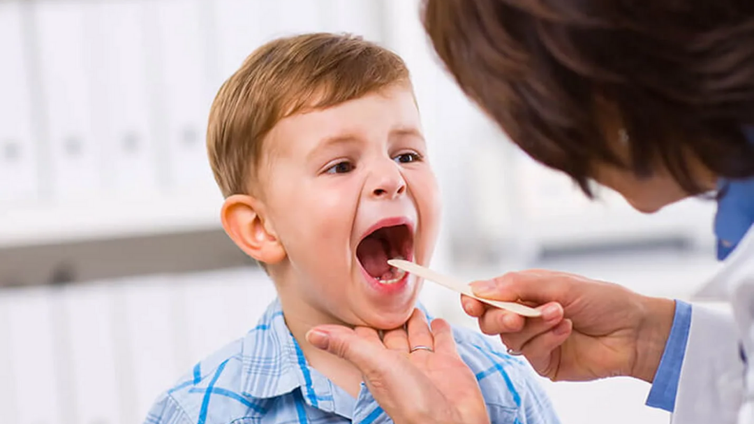 Грибки в горле у ребенка: опасно ли это? Лечение в Твери