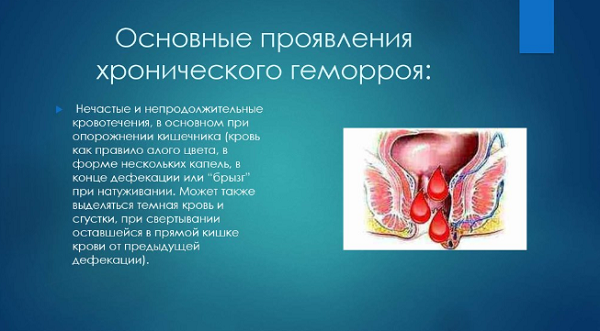 фото: https://en.ppt-online.org