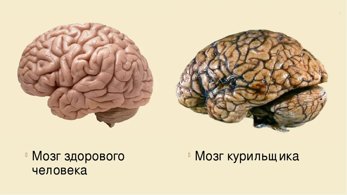 Как никотин влияет на мозг. Мозг курильщика и здорового человека.