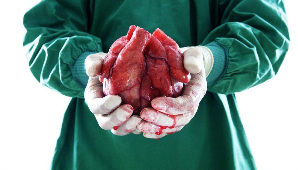 Взято из открытых источников - яндекс картинки