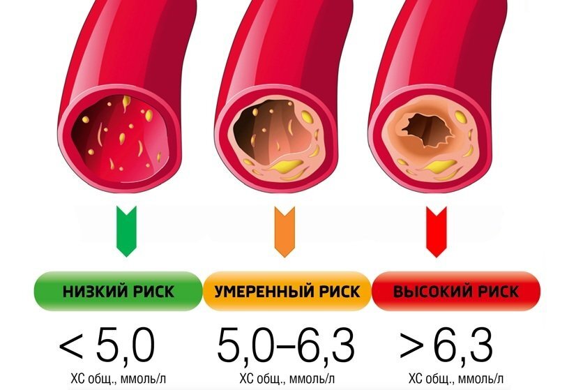 Повышенный сахар в крови и проблемы с сосудами у мужчин после 40.