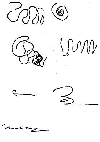 Шизофреник выполнил тест "Пиктограмма" (нужно, нарисовать, например, "Веселый праздник" одной пиктограммой, цифры и надписи запрещены. Всего 11 слов/выражений по 30 секунд на рисунок каждого ).