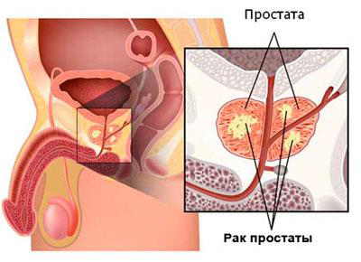 Анатомия репродуктивной системы (мужской)