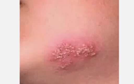 Фото взято из яндекс картинки