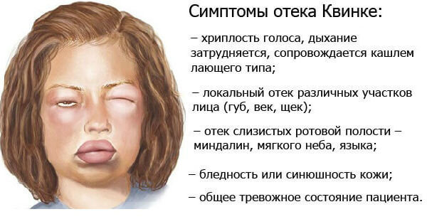 Зудящие дерматозы - презентация онлайн